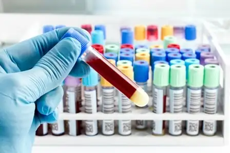 Verbrauchmaterial für Unternehmen aus dem Gesundheitsbereich - OfficeXpress
